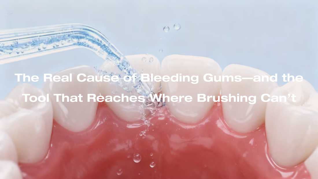 The Water Flosser: Understanding Its Specialized Role in Rapidly Resolving Gum Inflammation