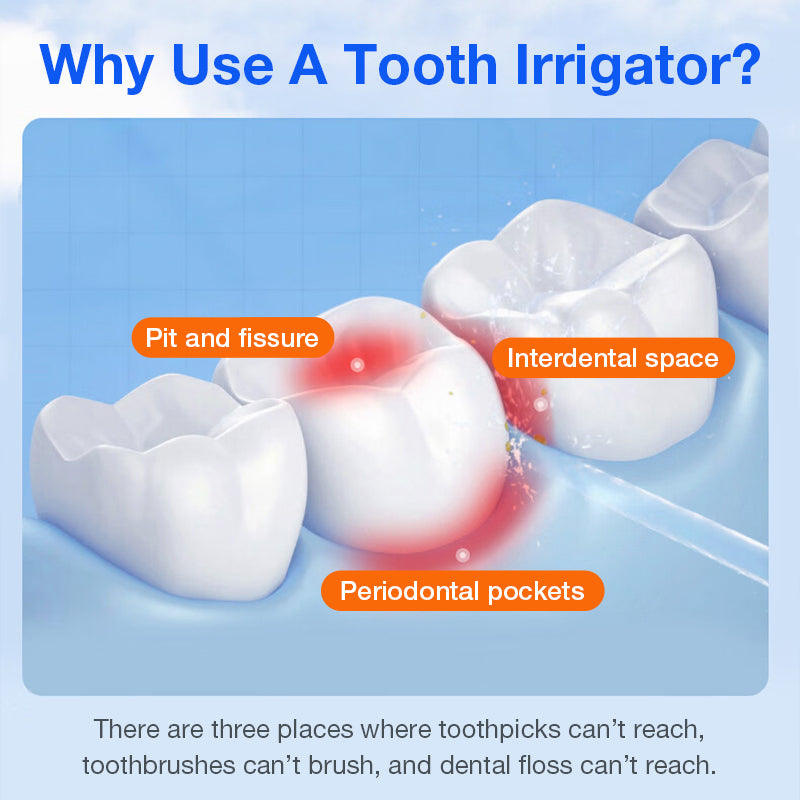 CF500 Portable Dental Flosser