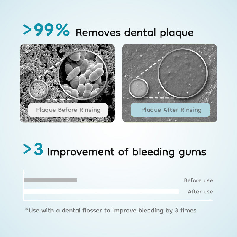 CF410 PORTABLE ORAL IRRIGATOR