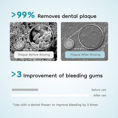 CF410 PORTABLE ORAL IRRIGATOR