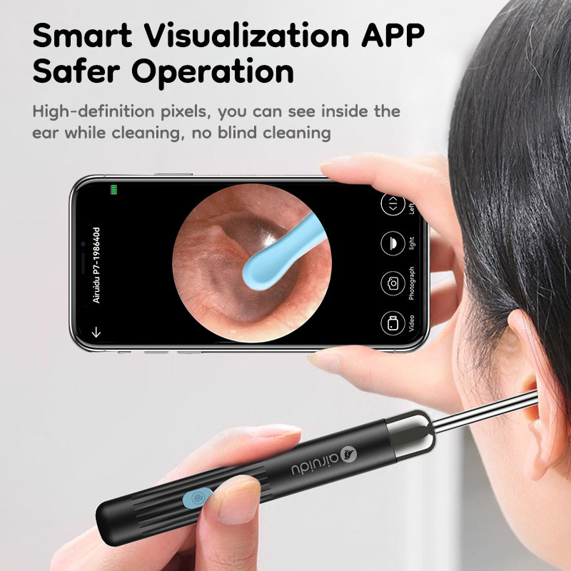 P7 Smart Visual Ear Picker