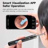 P7 Smart Visual Ear Picker